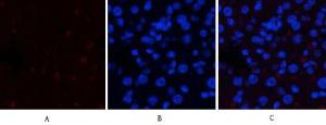 Immunofluorescence analysis of mouse liver tissue using Anti-JAK1 (phospho Tyr1022) Antibody (red) at 1:200 (4 °C overnight). Cy3 labelled secondary Antibody was used at 1:300 (RT 50 min). Panel A: Target. Panel B: DAPI. Panel C: Merge