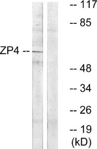 Western blot analysis of lysates from Jurkat cells using Anti-ZP4 Antibody. The right hand lane represents a negative control, where the antibody is blocked by the immunising peptide.