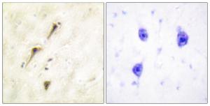 Anti-APC1 antibody