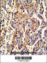 Anti-TYRP1 Rabbit Polyclonal Antibody