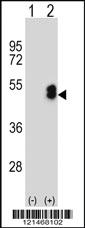 Anti-LMX1B Rabbit Polyclonal Antibody