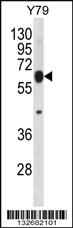 Anti-RNF180 Rabbit Polyclonal Antibody