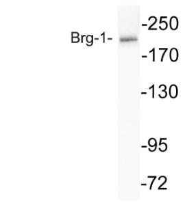 Anti-BRG1 Rabbit Polyclonal Antibody