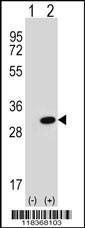 Anti-CA2 Rabbit Polyclonal Antibody