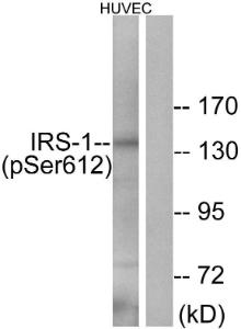 Western blot analysis of lysates from HUVEC cells treated with insulin 0.01U/ml 30' using Anti-IRS-1 (phospho Ser612) Antibody. The right hand lane represents a negative control, where the antibody is blocked by the immunising peptide