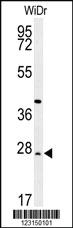 Anti-DIRAS3 Rabbit Polyclonal Antibody