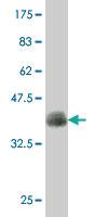 Anti-PBX2 Mouse Polyclonal Antibody