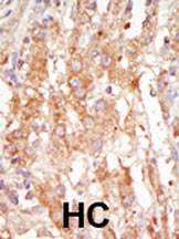 Anti-MAP3K6 Rabbit Polyclonal Antibody (FITC (Fluorescein))