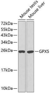 Western blot analysis of extracts of various cell lines, using Anti-GPX5 Antibody (A13045). The secondary antibody was Goat Anti-Rabbit IgG H and L Antibody (HRP) at 1:10,000 dilution. Lysates/proteins were present at 25 µg per lane. The blocking buffer used was 3% non-fat dry milk in TBST