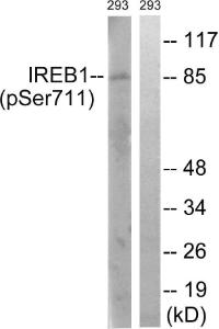 Anti-IREB2 + Aconitase 1 Rabbit Polyclonal Antibody