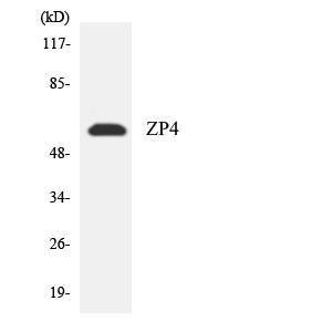 Western blot analysis of the lysates from HepG2 cells using Anti-ZP4 Antibody