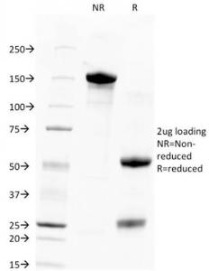 SDS-PAGE analysis of Anti-TROP2 Antibody [TACSTD2/2151] under non-reduced and reduced conditions; showing intact IgG and intact heavy and light chains, respectively SDS-PAGE analysis confirms the integrity and purity of the antibody