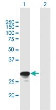 Anti-RAB26 Mouse Polyclonal Antibody