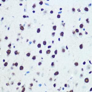 Immunohistochemistry analysis of paraffin-embedded mouse brain using Anti-hnRNP K Antibody [ARC0512] (A307298) at a dilution of 1:100 (40X lens). Perform microwave antigen retrieval with 10 mM PBS buffer pH 7.2 before commencing with IHC staining protocol