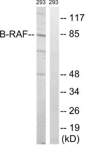 Western blot analysis of lysates from 293 cells, treated with insulin 0.01U/ml 15' using Anti-B-RAF Antibody. The right hand lane represents a negative control, where the antibody is blocked by the immunising peptide.