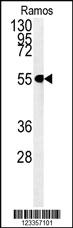 Anti-MATN3 Rabbit Polyclonal Antibody