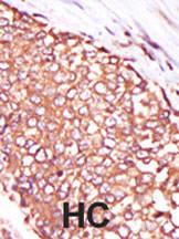 Anti-PRKCQ Rabbit Polyclonal Antibody (PE (Phycoerythrin))