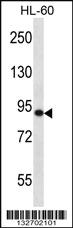 Anti-SP140 Rabbit Polyclonal Antibody