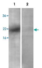 Anti-PDCD6 Rabbit Polyclonal Antibody