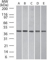 Anti-ACTB Rabbit Polyclonal Antibody