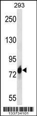 Anti-CDH16 Rabbit Polyclonal Antibody (PE (Phycoerythrin))