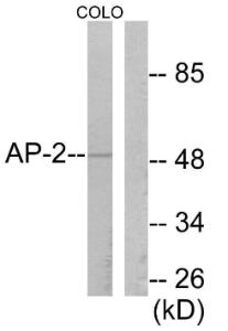 Western blot analysis of lysates from COLO205 cells using Anti-AP-2 Antibody. The right hand lane represents a negative control, where the antibody is blocked by the immunising peptide