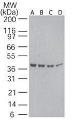 Anti-ACTB Rabbit Polyclonal Antibody