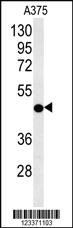 Anti-CS Rabbit Polyclonal Antibody