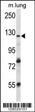 Anti-VPS54 Rabbit Polyclonal Antibody