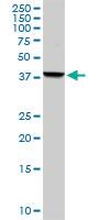 Anti-CK19 Rabbit Polyclonal Antibody