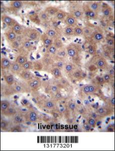 Anti-CDH19 Rabbit Polyclonal Antibody