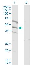 Anti-SPATA5L1 Rabbit Polyclonal Antibody