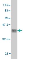 Anti-PBX2 Mouse Monoclonal Antibody [clone: 2E9]