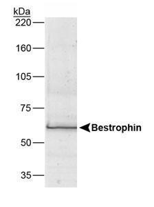 Anti-POT1 Rabbit Polyclonal Antibody (DyLight® 650)