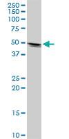 Anti-CK32 Mouse Polyclonal Antibody