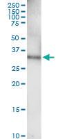 Anti-EPHA7 Polyclonal Antibody Pair