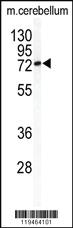 Anti-NNMT Rabbit Polyclonal Antibody