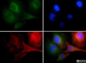 Anti-CDKN2A Rabbit Polyclonal Antibody (HRP (Horseradish Peroxidase))