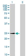 Anti-METTL7A Mouse Polyclonal Antibody