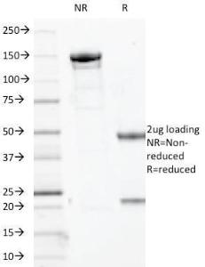 SDS-PAGE analysis of Anti-SOX10 Antibody [SOX10/1074] under non-reduced and reduced conditions; showing intact IgG and intact heavy and light chains, respectively. SDS-PAGE analysis confirms the integrity and purity of the antibody