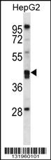 Anti-PON2 Rabbit Polyclonal Antibody