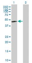 Anti-CK32 Mouse Polyclonal Antibody