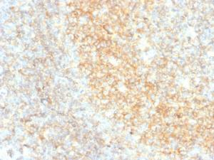 Immunohistochemical analysis of formalin-fixed, paraffin-embedded human tonsil using Anti-CD40 Antibody [C40/4826R]