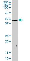 Anti-CK32 Mouse Polyclonal Antibody