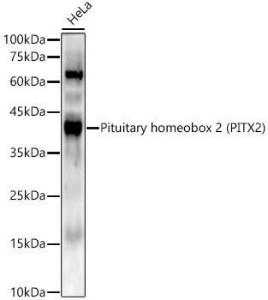 Western blot analysis of HeLa, using Anti-PITX2 / RGS Antibody [ARC56103] (A307302) at 1:2,000 dilution. The secondary antibody was Goat Anti-Rabbit IgG H&L Antibody (HRP) at 1:10,000 dilution.