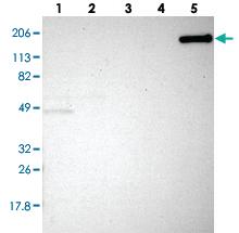 Anti-MYOM2 Rabbit Polyclonal Antibody