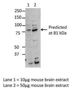 Anti-MARK3 Rabbit Polyclonal Antibody