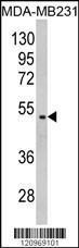 Anti-GALT Rabbit Polyclonal Antibody (PE (Phycoerythrin))