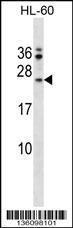 Anti-FAIM Rabbit Polyclonal Antibody (FITC (Fluorescein Isothiocyanate))