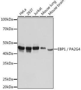 Anti-EBP1 Rabbit Monoclonal Antibody [Clone: ARC1281]